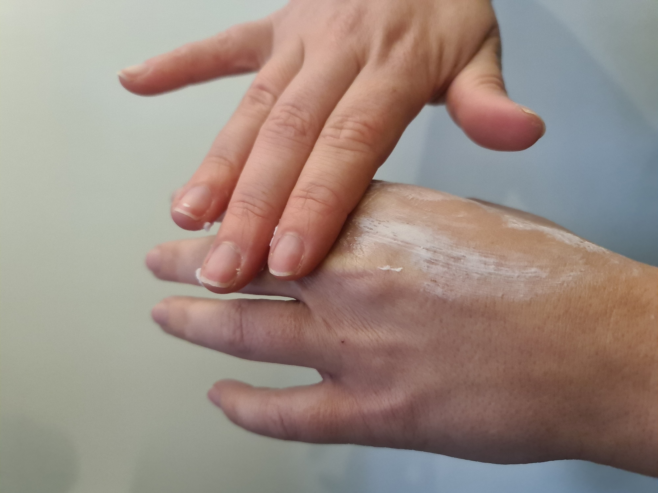 Comment soigner une crevasse sur les mains ? Dermophil